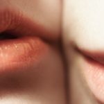 Schöne, volle Lippen, Lippenvolumen, Lasertechnik, Dr. Darius Alamouti, Marina Jagemann