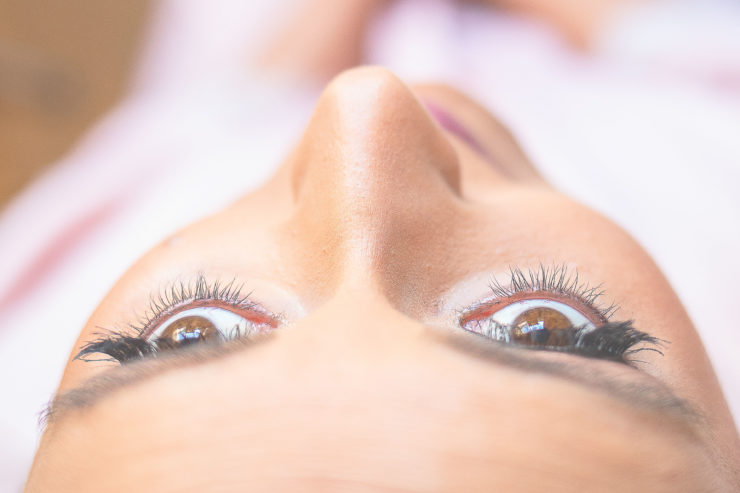 Geschwollene Augen und Tränensäcke