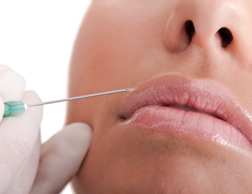 Lippen mit Filler aufspritzen