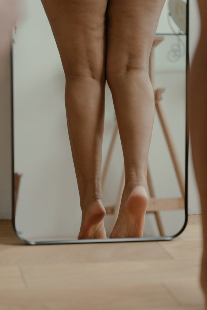 Frauenbeine vor Spiegel um Lipödem zu erkennen