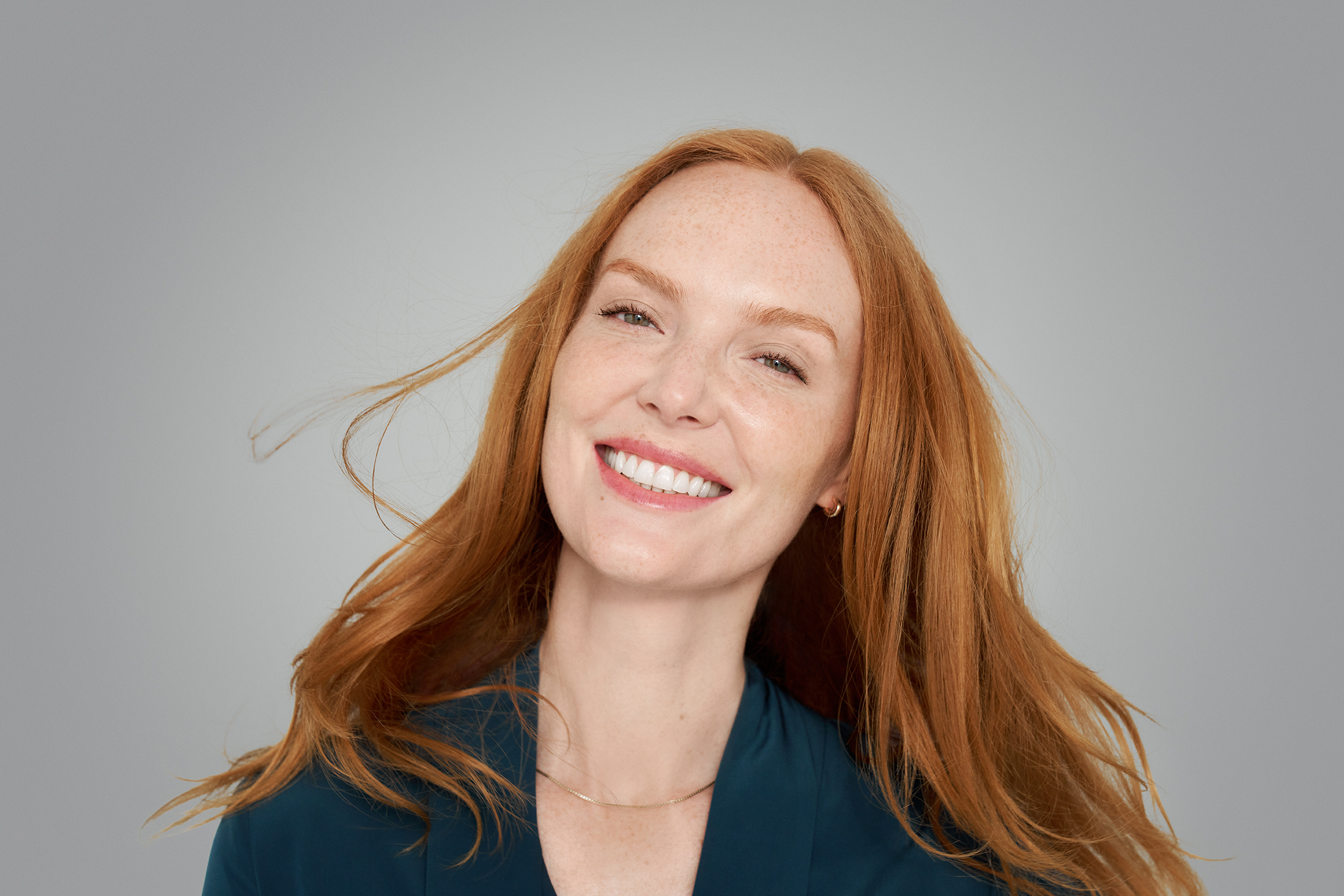 Junge Frau bei der die Jawline mit Hyaluronsäure unterspritzt wurde